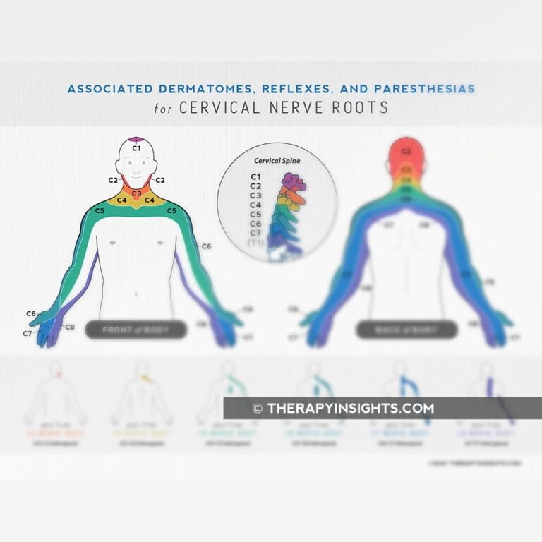 Associated Dermatomes Reflexes And Paresthesias For Cervical Nerve Roots Printable Handouts For