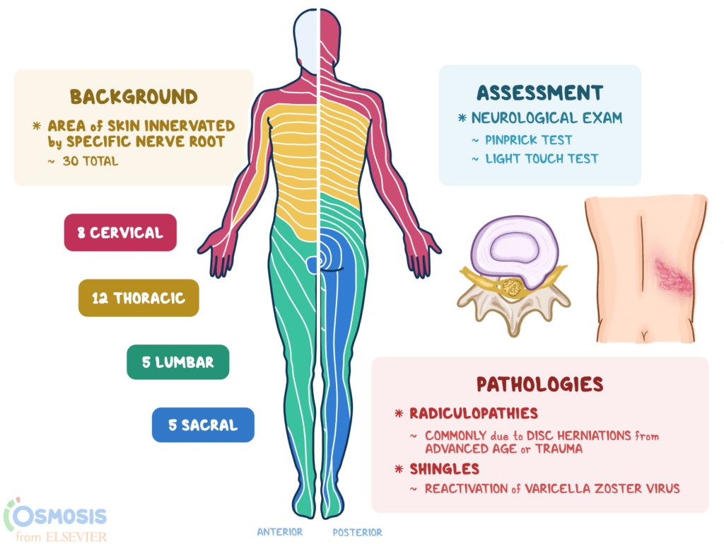 Thoracic Dermatome Shingles Dermatomes Chart And Map