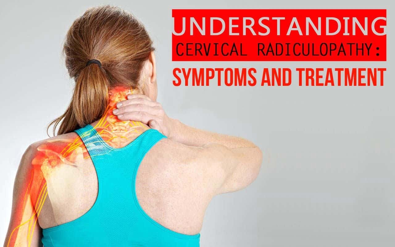 Symptoms Treatment Of Cervical Radiculopathy Copperjoint Dermatomes Chart And Map