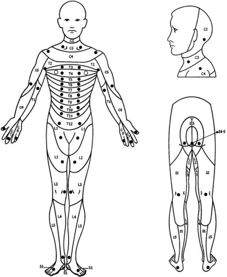 Brainbook On Twitter 29 A Dermatome Is An Area Of Skin Supplied By A ...