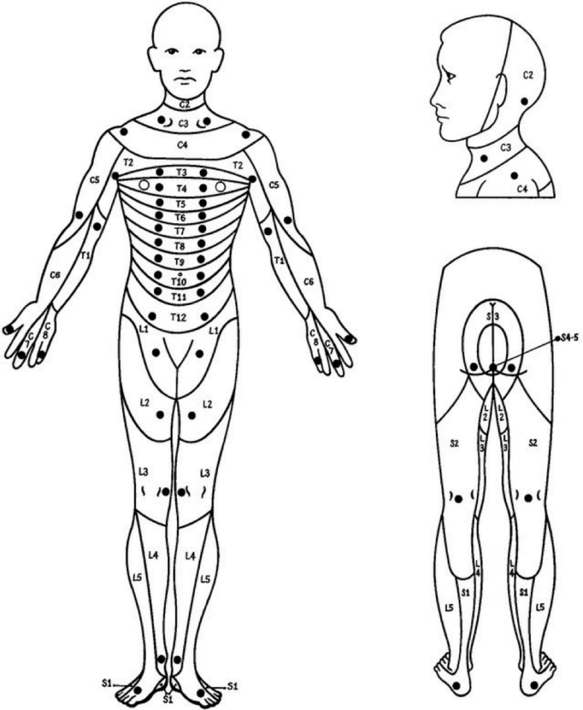 Fill In The Blank Dermatome Chart