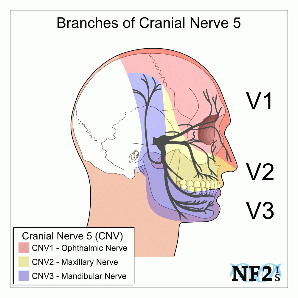 Trigeminal Neuralgia Nerve Branches