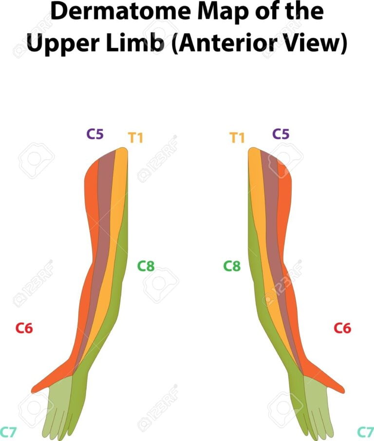 Dermatome Map Of The Upper Limb Labeled Diagram Royalty Free Svg Cliparts Vectors And Stock