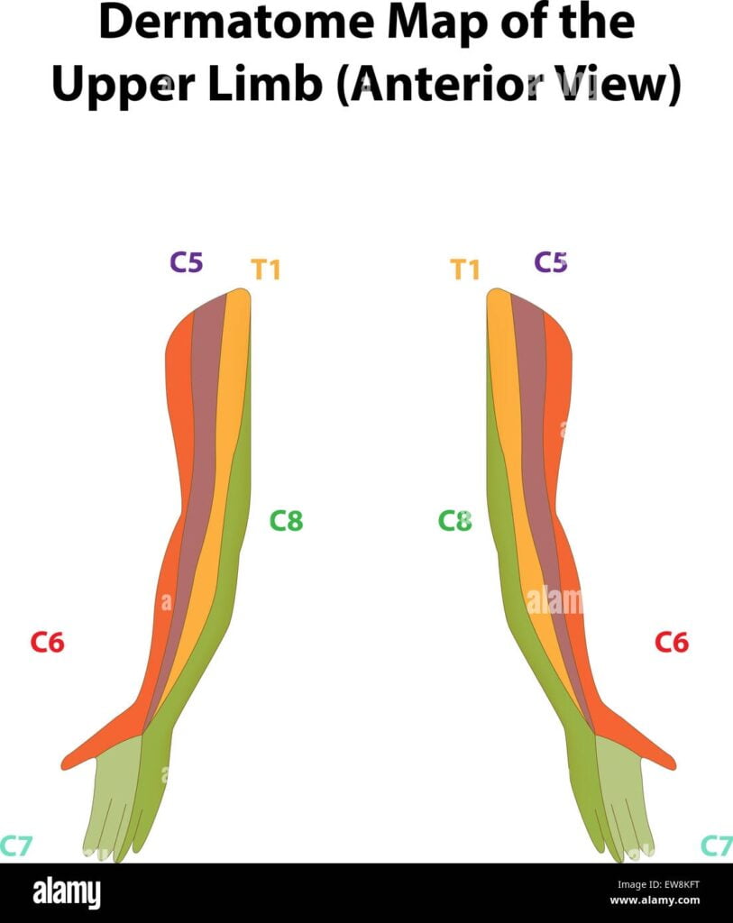 Dermatome Map Of The Upper Limb Stock Photo Alamy