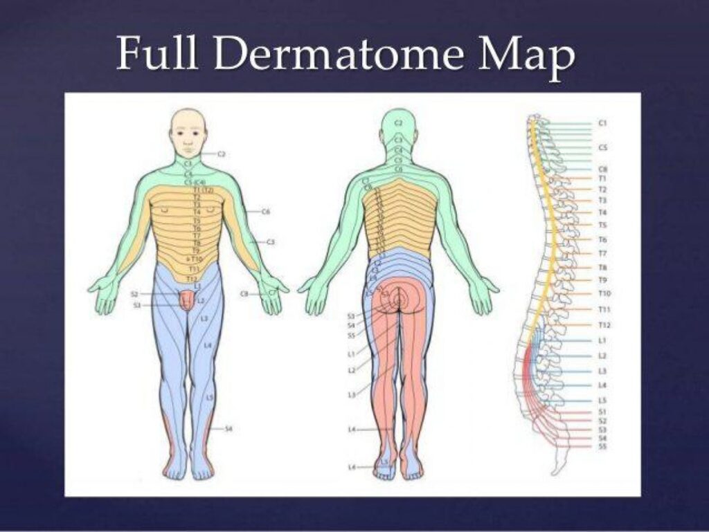 Spinal Cord Injury Dermatome Map - Dermatomes Chart and Map