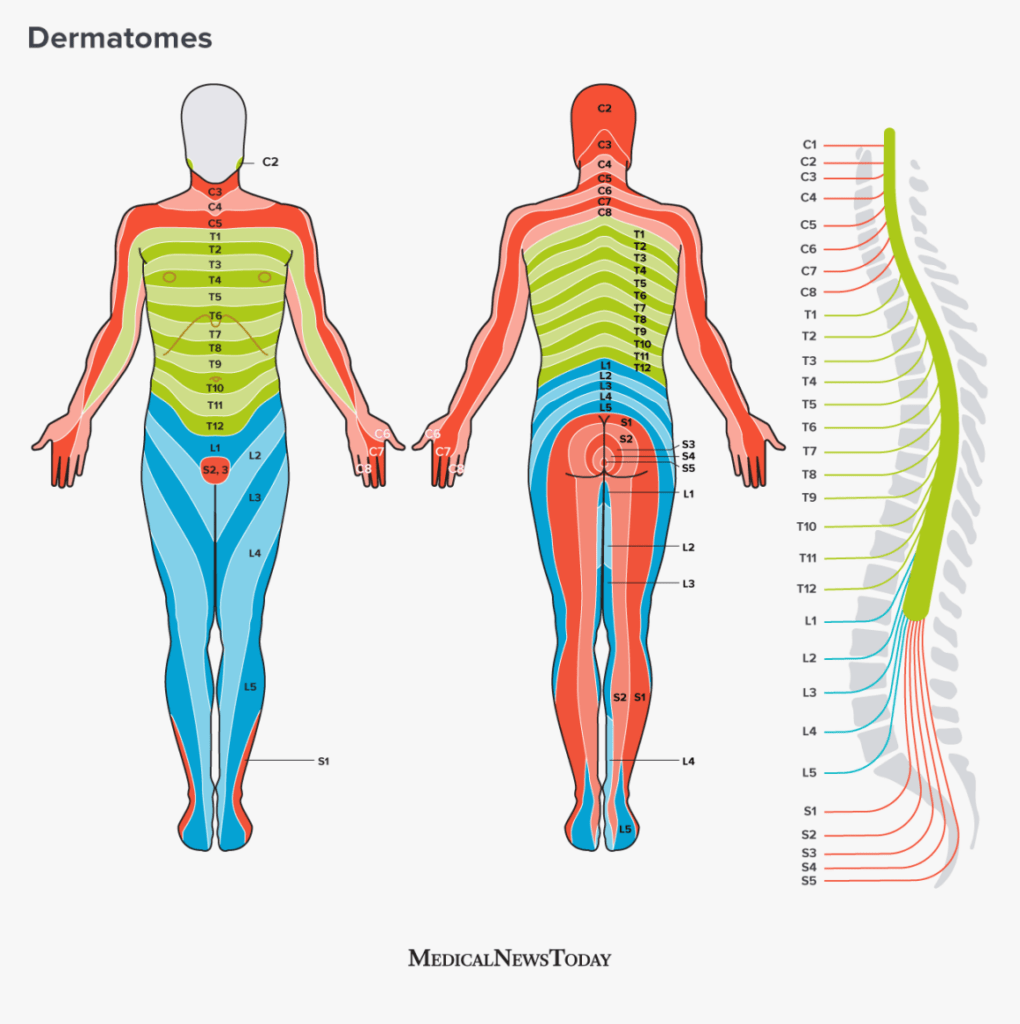 Epidural Dermatome Chart - Dermatomes Chart and Map