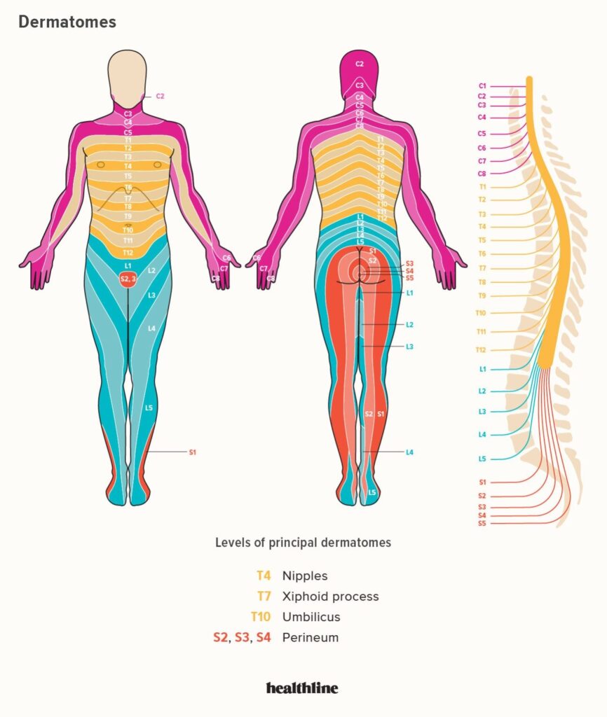 Dermatomes Diagram Spinal Nerves And Locations Spinal Nerve Spinal Nerves Anatomy Nerve Anatomy