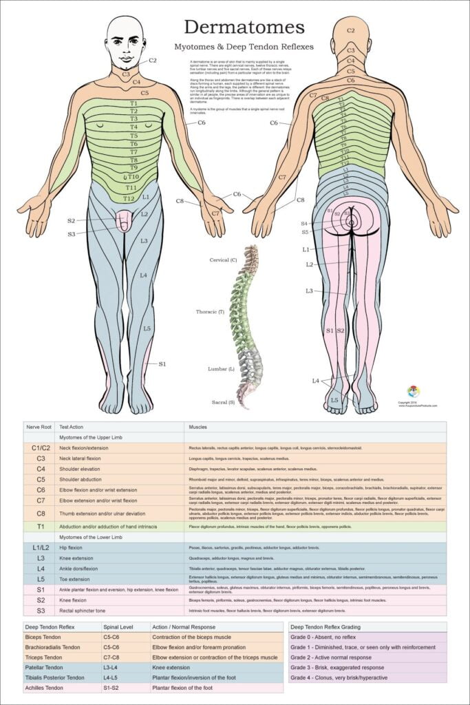 Dermatome Chart Map Poster
