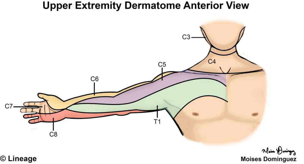 Upper Extremity Dermatome Chart
