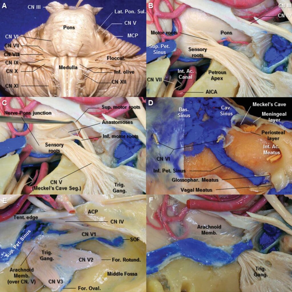 Topography Of Trigeminal Nerve
