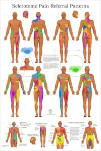 Color Sclerotome Visceral Pain Referral Poster