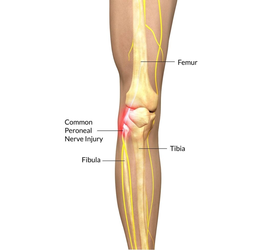 accessory-peroneal-nerve-dermatome-dermatomes-chart-and-map