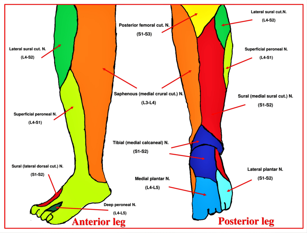 Cureus Anatomical And Technical Considerations Of The Hi PAC Hi Volume Proximal Adductor Canal Block A Novel Motor Sparing Regional Analgesia Technique For Below Knee Surgeries