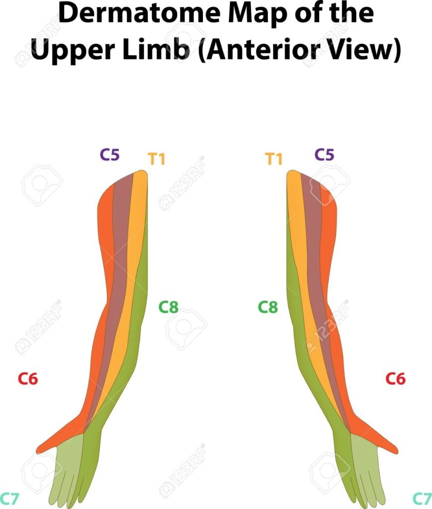 Dermatome Map Of The Upper Limb Labeled Diagram Royalty Free SVG Cliparts Vectors And Stock Illustration Image 37466517 