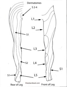 Dermatome Patterns Dermatome Map Of Lower Body Spine N Flickr