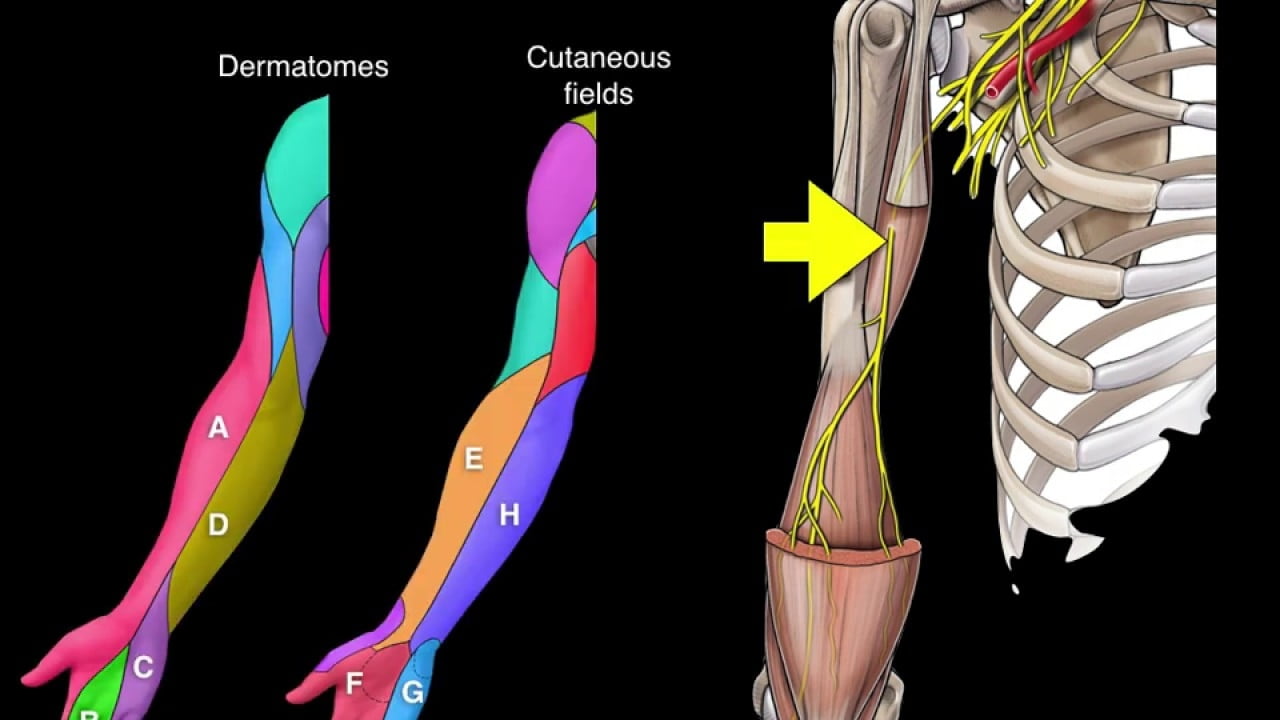 Dermatome Vs Peripheral Nerve Presentation Dermatomes Chart And Map