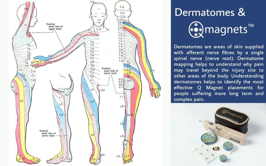 Dermatomes How Dermatomes Affect Q Magnet Application For Treating Chronic And Persistent Pain