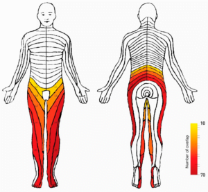 Diagnostics Free Full Text Associations Between Patient Report Of Pain And Intervertebral Foramina Changes Visible On Axial Loaded Lumbar Magnetic Resonance Imaging