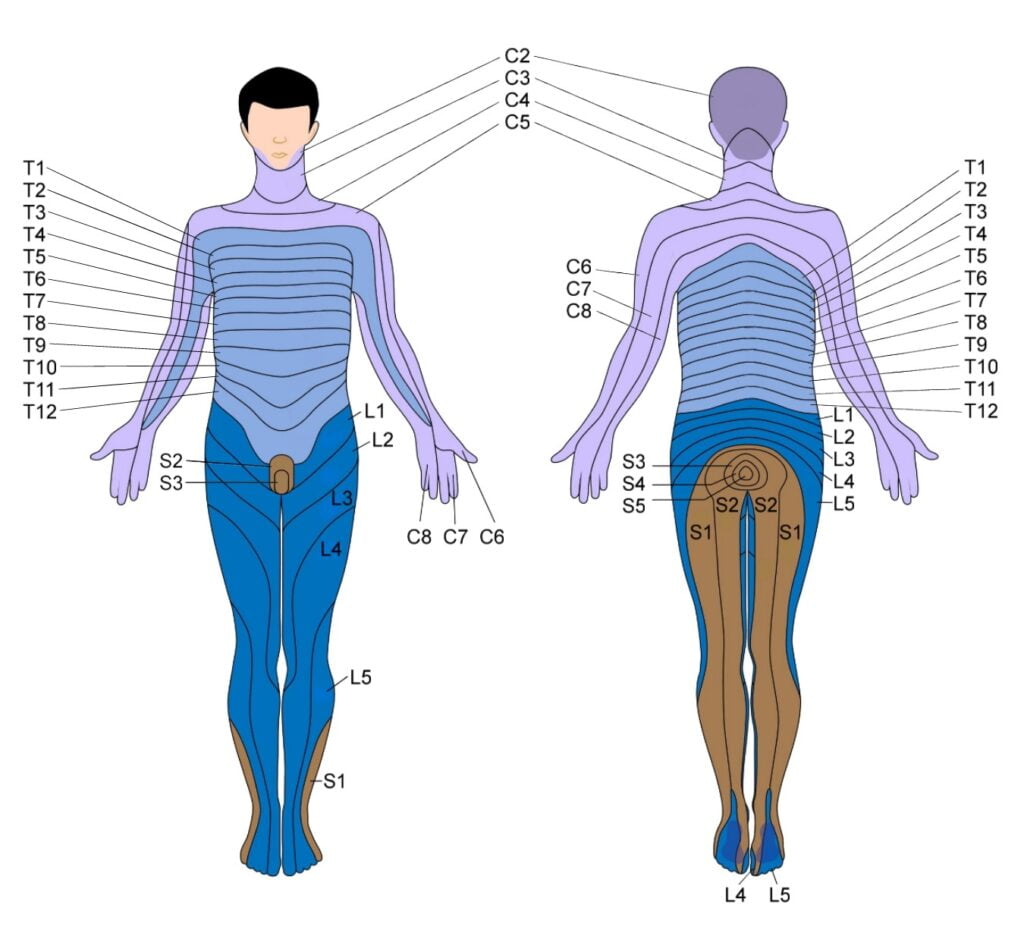 Dermatome Thoracic 6 Bulging Disc - Dermatomes Chart and Map