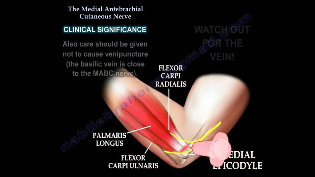 Medial Antebrachial Cutaneous Nerve Dermatome