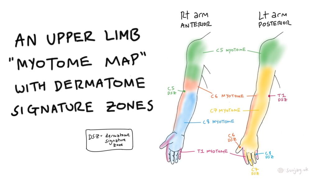 Unmarked Dermatomes Map Upper Limb