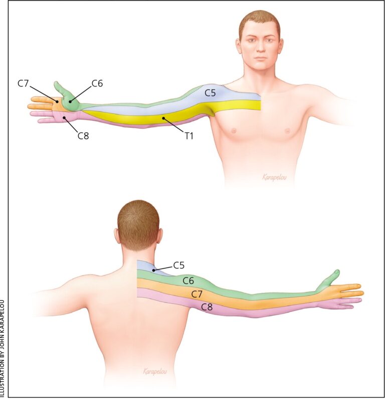 Nonoperative Management Of Cervical Radiculopathy Aafp - Dermatomes 