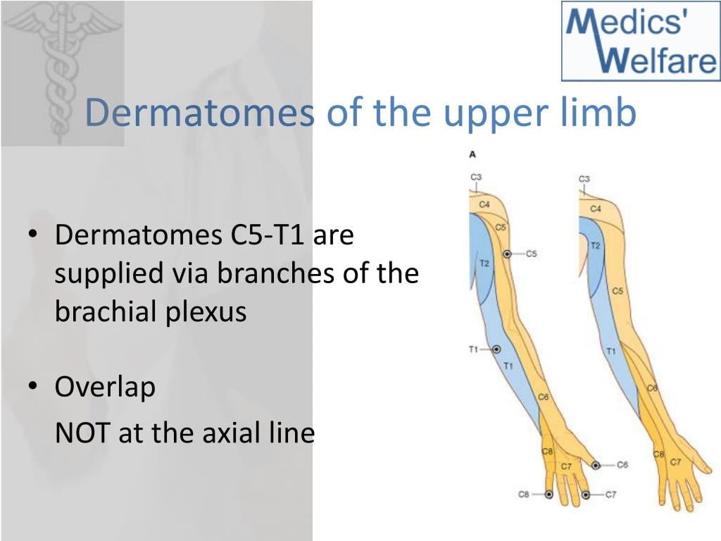 Dermatome Of Upper Limb Ppt