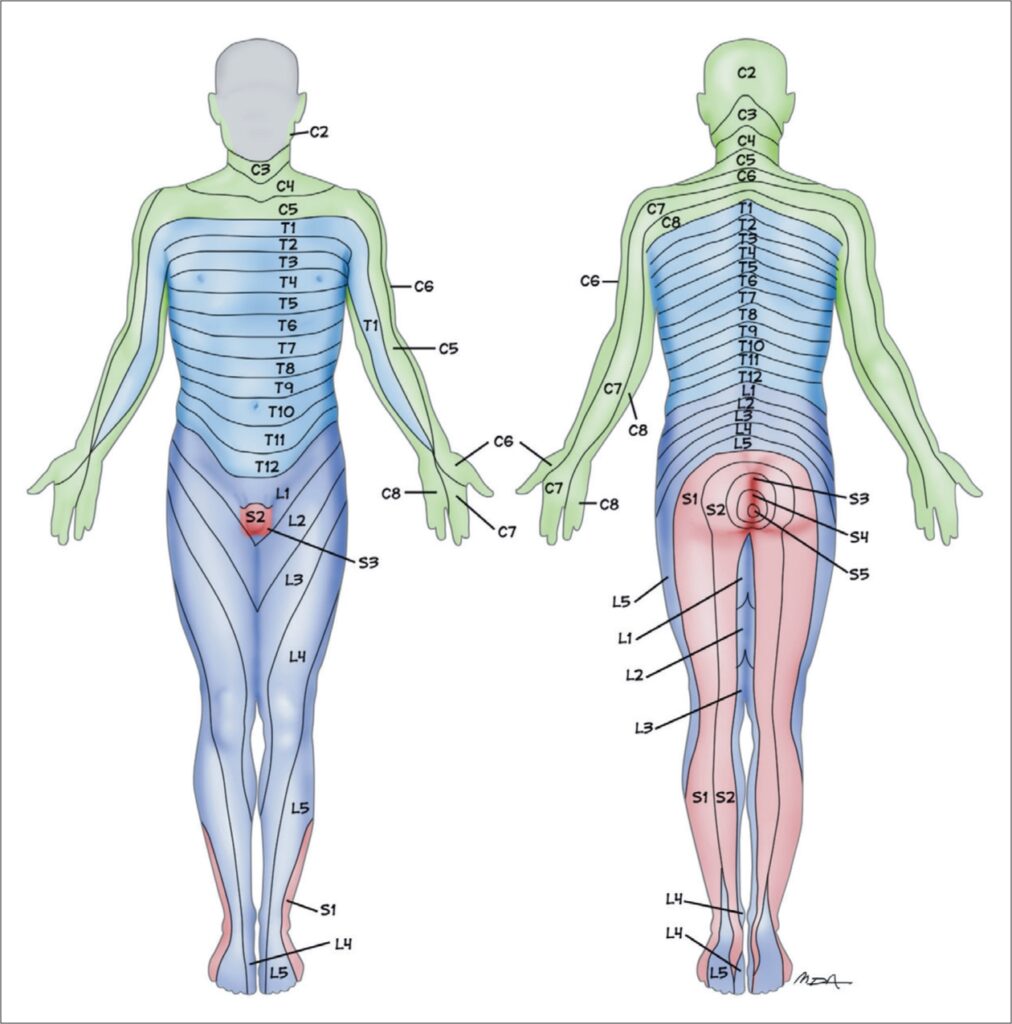 Dermatomal Pattern Shingles