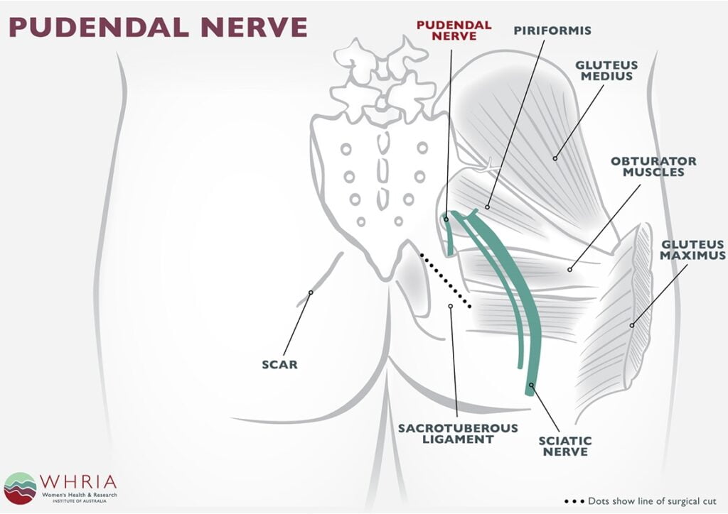 Pudendal Nerve Block Dermatome