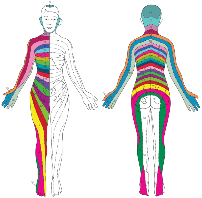 radiculitis-radicular-pain-causes-symptoms-treatment-dermatomes-chart