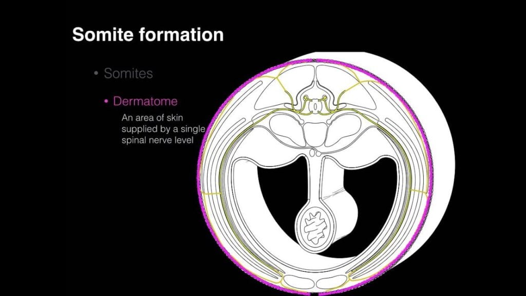 Embryologic Sclerotome Vs Dermatome Patterns