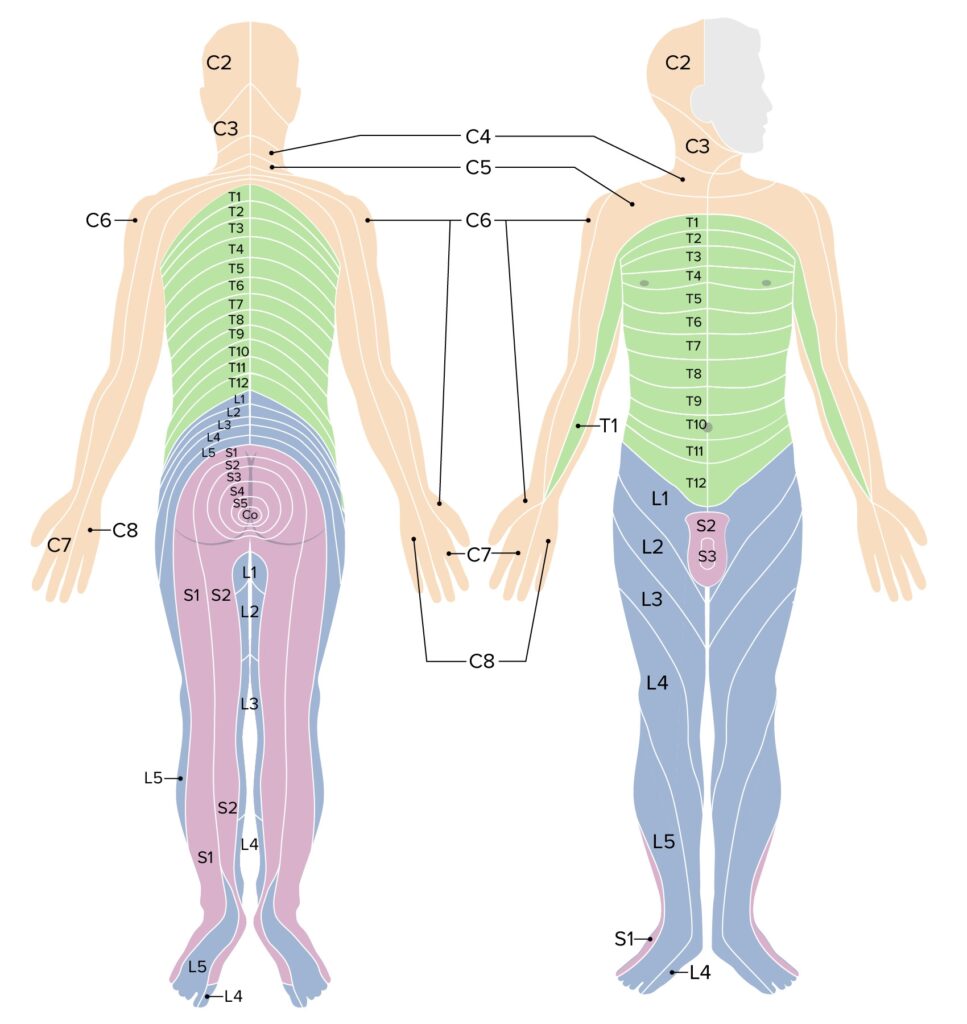 Spinal Anesthesia Dermatomes Map