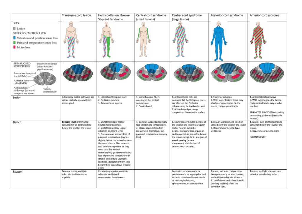 Ipsilateral Dermatome Spinal Cord Injury