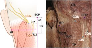 Stereotactic Topography Of The Greater And Third Occipital Nerves And Its Clinical Implication Scientific Reports