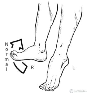 The Common Fibular Nerve Course Motor Sensory TeachMeAnatomy