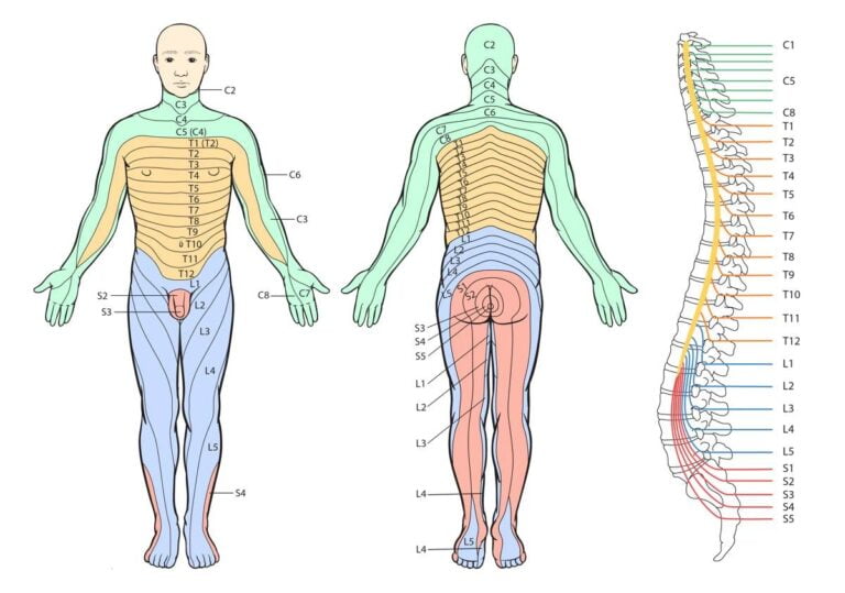 Understanding Referred And Radicular Pain Recovery Medical Dermatomes Chart And Map